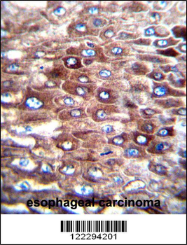 CJ057 Antibody (C-term)