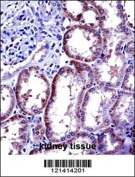 IL6 Antibody (Center)