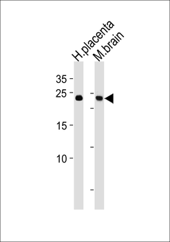 SOX15 Antibody (Center)