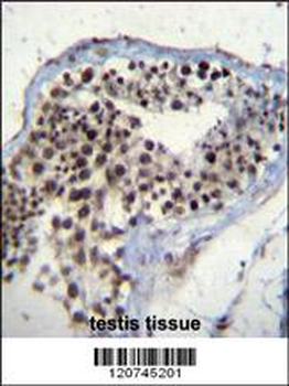 SOX15 Antibody (Center)