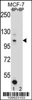 HIPK1 Antibody (C-term)