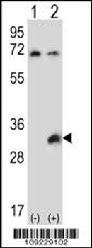 TSSK6 Antibody (C-term)