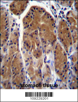 TSSK6 Antibody (C-term)