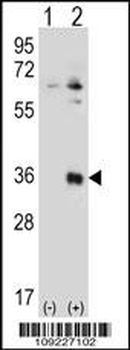 TSSK6 Antibody (N-term)
