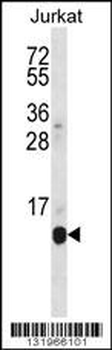 POLR2G Antibody (C-term)