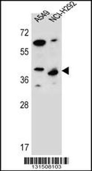 LRRC67 Antibody (C-term)