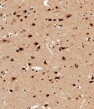 SNRPD3 Antibody (N-term)