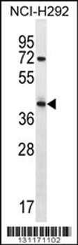 ARRDC5 Antibody (N-term)