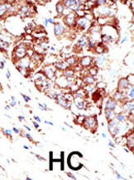 PIAS1 Antibody (C-term)