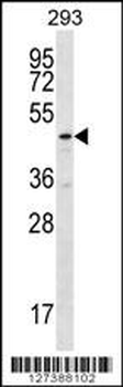TBCEL Antibody (C-term)