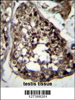 TBCEL Antibody (C-term)