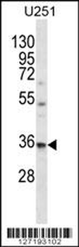 VPS37B Antibody (Center)