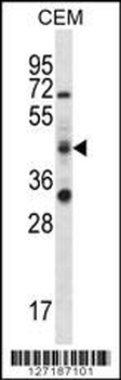 RBM42 Antibody (C-term)