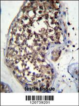 FBXO15 Antibody (N-term)