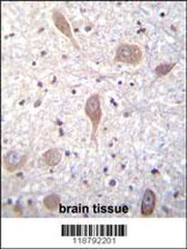 VSGP/F-spondin Antibody (N-term)