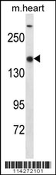 SET1B Antibody (C-term)