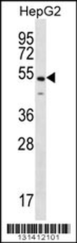 NKAP Antibody (C-term)