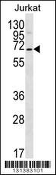 PSAPL1 Antibody (N-term)
