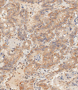 DLL3 Antibody (C-term)