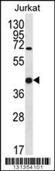 LGALS4 Antibody (N-term)