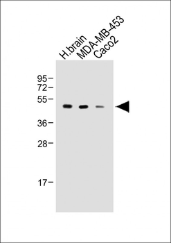 KCNJ13 Antibody (N-term)