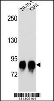 POMT1 Antibody (C-term)