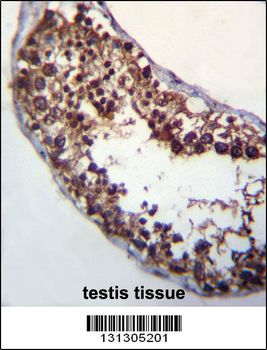 POMT1 Antibody (C-term)