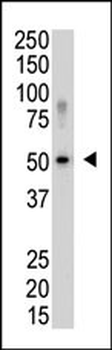 SENP5 Antibody (C-term)