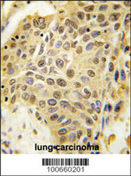 SENP5 Antibody (C-term)