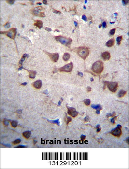 PIGA Antibody (C-term)