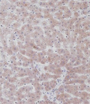 UGT2B15 Antibody (Center)