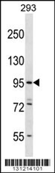 ESPNL Antibody (C-term)