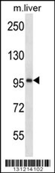 ESPNL Antibody (C-term)