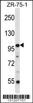 ZNF845 Antibody (N-term)