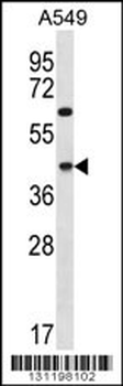 C109B Antibody (C-term)