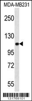 ACTN3 Antibody (Center)