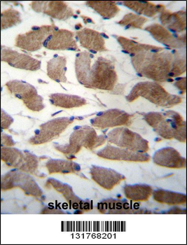 ACTN3 Antibody (Center)