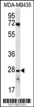 OR10AG1 Antibody (C-term)