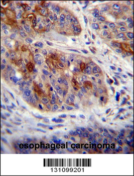 HAX1 Antibody (C-term)