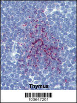 SENP1 Antibody (N-term)