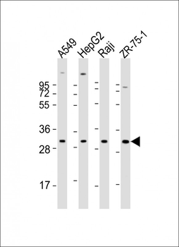 PDCD1LG2 Antibody (N-term)