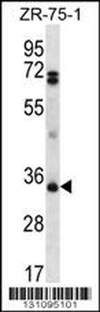 PDCD1LG2 Antibody (N-term)