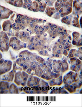 PDCD1LG2 Antibody (N-term)
