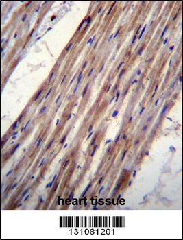KCNJ8 Antibody (N-term)