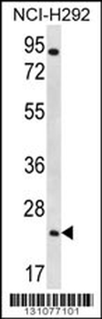AQP5 Antibody (C-term)