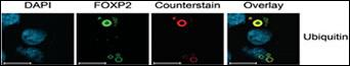 Ubiquitin Antibody
