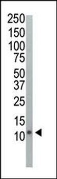 Ubiquitin Antibody