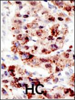 Ubiquitin Antibody