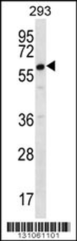 DAZ2 Antibody (C-term)
