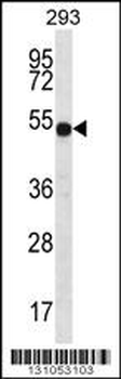 ATP6V1B1 Antibody (C-term)
